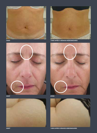 Esthetique_Oasis_Services_MPR_Toroidale_Resultats Les nouveautés No2ctuelle